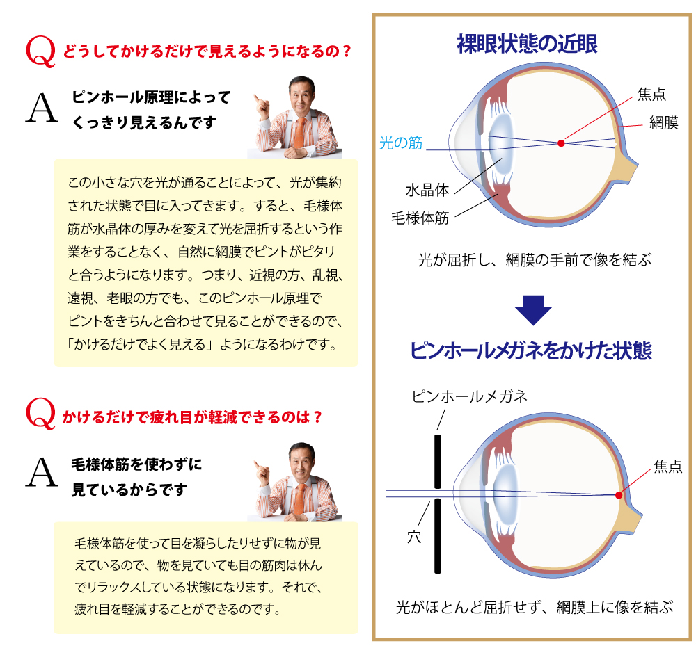ビジョンプロテクトQ&A